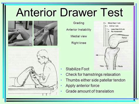 Anterior drawer test for ACL injury... | Physical therapy school, Physical therapy student ...