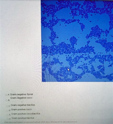 SOLVED: Select Apply A Gram-negative Spiral Gram-negative cocci Gram-negative bacillus Gram ...