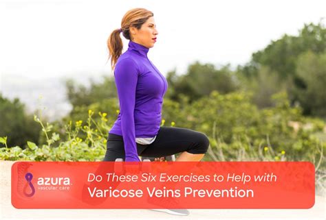 Six Exercises to Help Prevent Varicose Veins