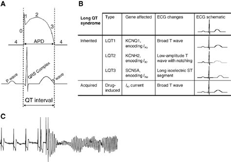 A) An action potential (AP, top) in relation to the ECG (below). During ...