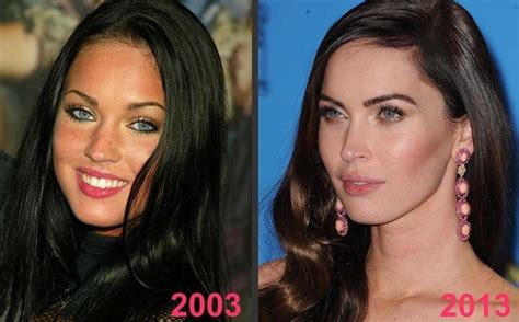 Megan Fox - Are plastic surgery rumors true?