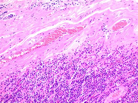 Hematoxylin and Eosin Stain Kit