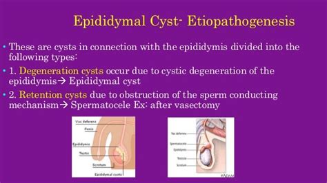 Scrotal swellings 3- Epididymal cyst