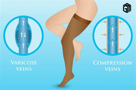 Relieve Your Pain: Discover the Best Compression Socks for Swelling