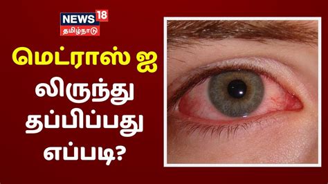 மீண்டும் அச்சுறுத்தும் Madras Eye - தப்பிப்பது எப்படி? | Madras Eye ...