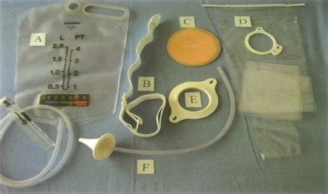 Colostomy irrigation: A method of bowel management | Omnigon