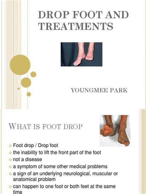 Drop Foot Treatments | PDF | Foot | Neurology