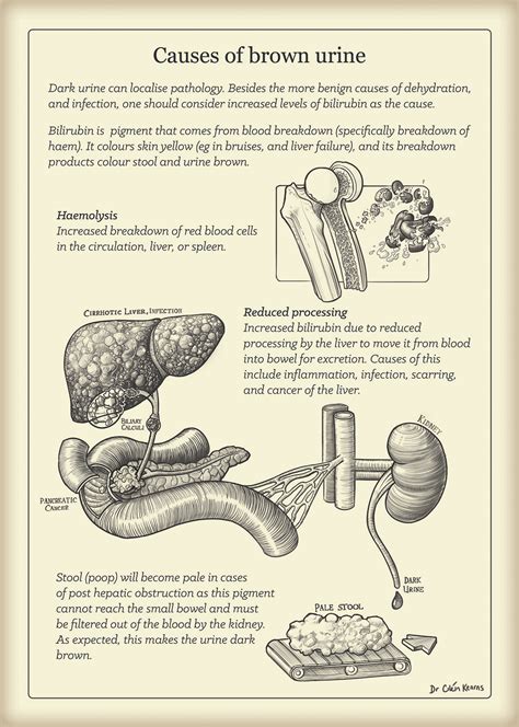 How to 'read' urine colour — artibiotics