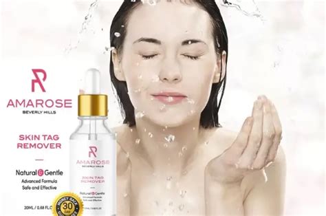 Super Luxe Skin Tag Remover Reviews 2023: Does It Really Work? Find Out!