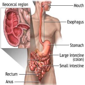 6 Most Common Symptoms Of Crohn Disease - Early Signs And Symptoms Of ...