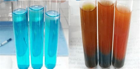 Benedict's Test- Principle, Preparation, Procedure, and Result