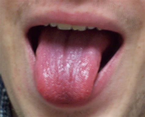 Look at your tongue, check your health