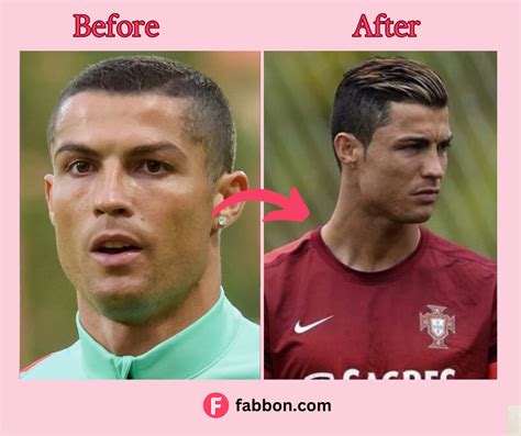 Did Cristiano Ronaldo Have Plastic Surgery? Doctors Say Yes! | Fabbon