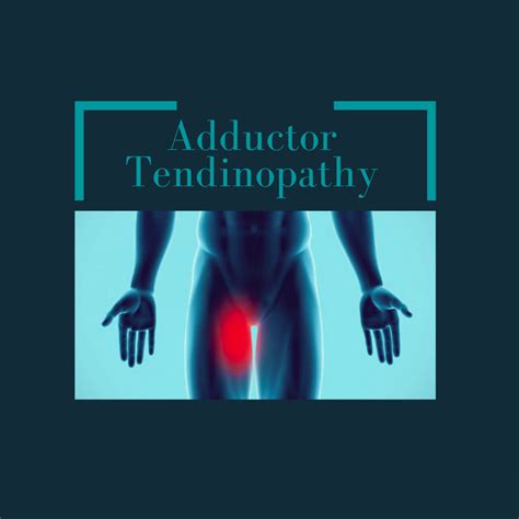 Physiotherapy For Adductor Tendinopathy - Enhance Physiotherapy