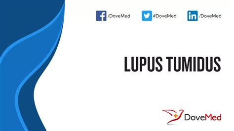 Lupus Tumidus - DoveMed