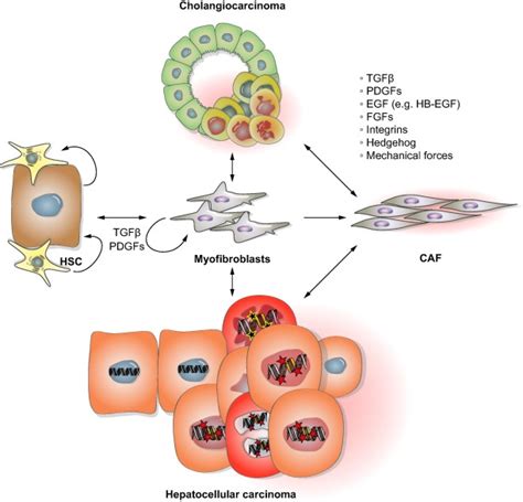 Role of desmoplasia in cholangiocarcinoma and hepatocellular carcinoma - Journal of Hepatology