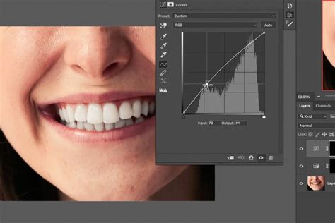 How to Whiten Teeth in Photoshop - PHLEARN