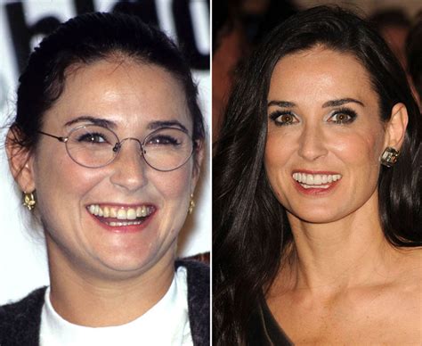 Demi Moore then and now teeth | Celebrity teeth transformations ...