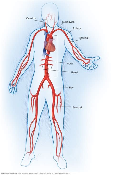 Takayasu's arteritis - Symptoms and causes - Mayo Clinic