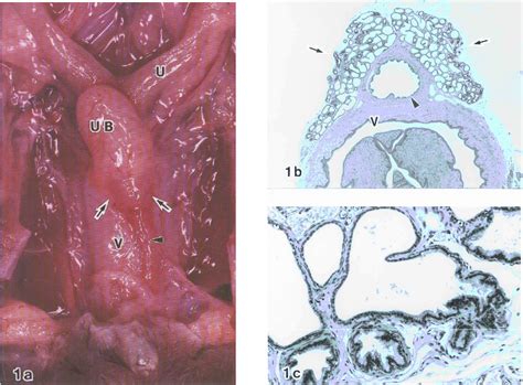 Paraurethral Gland Histology - vrogue.co