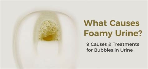 9 Possible Causes of Foamy Urine and How Is It Treated | Urinal, Foamy ...