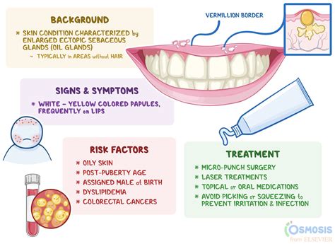 Fordyce Spots: What Are They, Causes, Treatment, and More | Osmosis