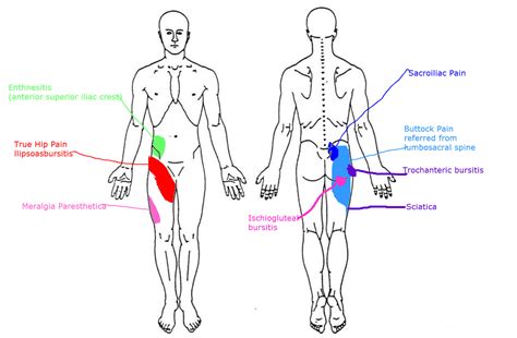 Relieve Glute and Thigh Pain