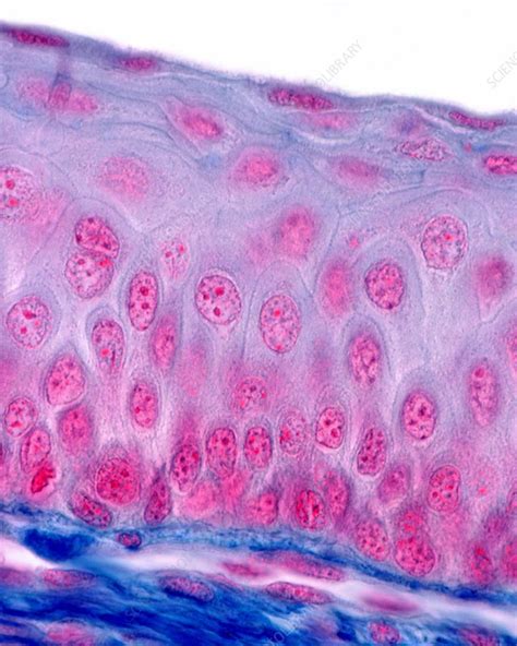 Keratinized Stratified Squamous Epithelium : Non-keratinized stratified squamous epithelium ...