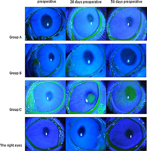 Images of the corneal fluorescein staining (16×). There was no punctate... | Download Scientific ...