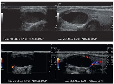 Neck | Radiology Key