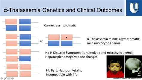 Hemoglobinopathies Part 3: Alpha Thalassemia - YouTube