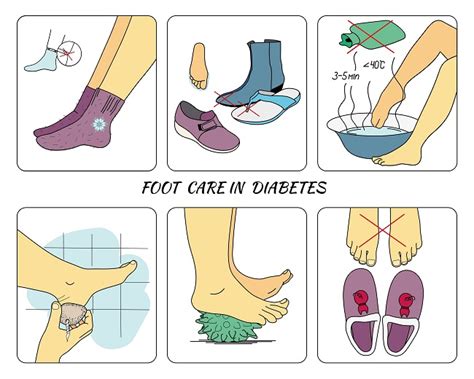 Diabetic Foot Care. Important Foot Care Tips to Follow.