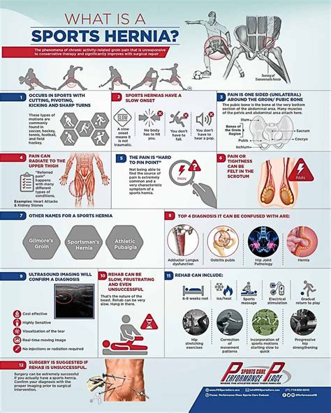 12 Truths About Sports Hernias Your Doctor Didn’t Tell You - Performance Place Sports Care ...