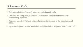 Cleft Lip and Palate | PPT