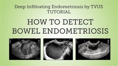 Pin on ultrasound notes