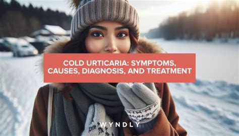 Cold Urticaria: Identifying Symptoms and Effective Treatments (2024 ...