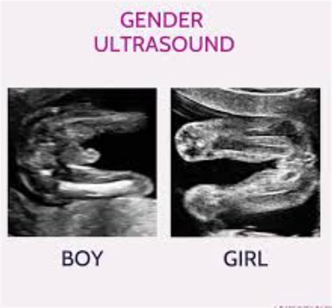 Your First Ultrasound Can Tell The Gender Of Your Baby? - Ur Baby Blog