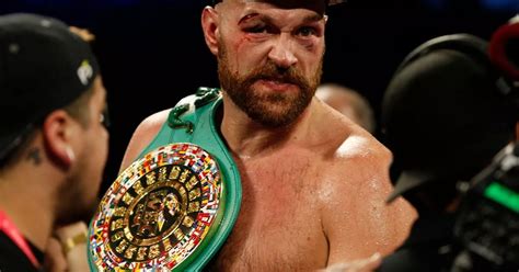 Tyson Fury taken to hospital after suffering gruesome eye injury during ...