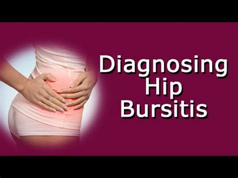 Diagnosing Hip Bursitis - YouTube