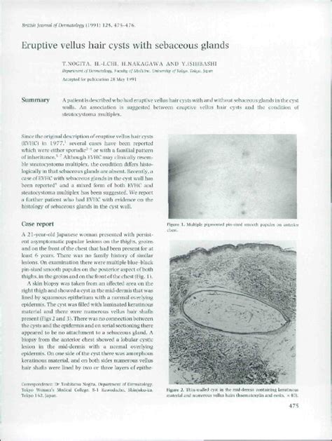 (PDF) Eruptive vellus hair cysts with sebaceous glands | Toshitatsu Nogita - Academia.edu