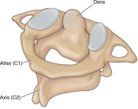 Atlanto-Axial Joint Injections | Anesthesia Key