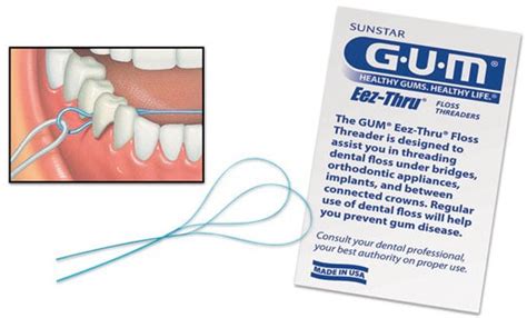 How To Use Dental Floss For Bridges - Best Image Viajeperu.org