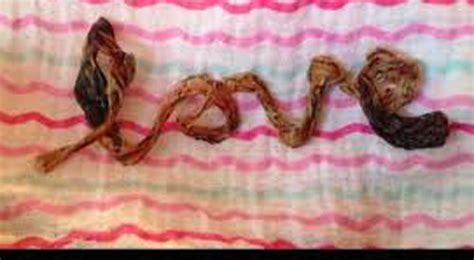 Yes, Umbilical Cord Art Is Really A Thing | Weird But True News