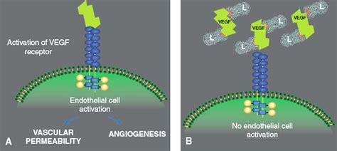 Ranibizumab (Ranibizumab) in the Treatment of Wet Macular Degeneration ...