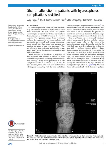 (PDF) Shunt malfunction in patients with hydrocephalus: complications ...