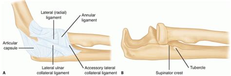 Lateral Collateral Ligament Reconstruction of the Elbow ...