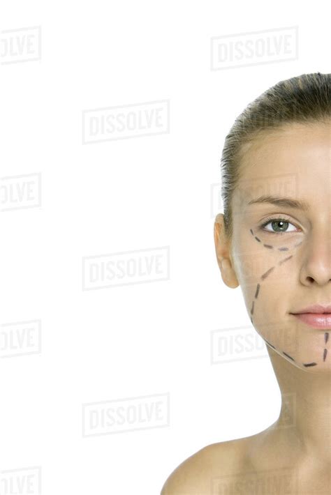 Woman with plastic surgery markings on face, looking at camera, cropped - Stock Photo - Dissolve