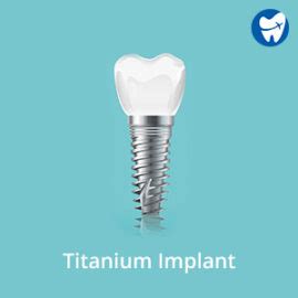 Titanium Vs. Zirconia Tooth Implants: Cost, properties, pros & cons