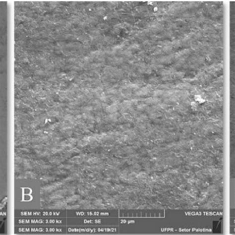 Scanning electron microscopy of the tooth enamel surface on the control... | Download Scientific ...