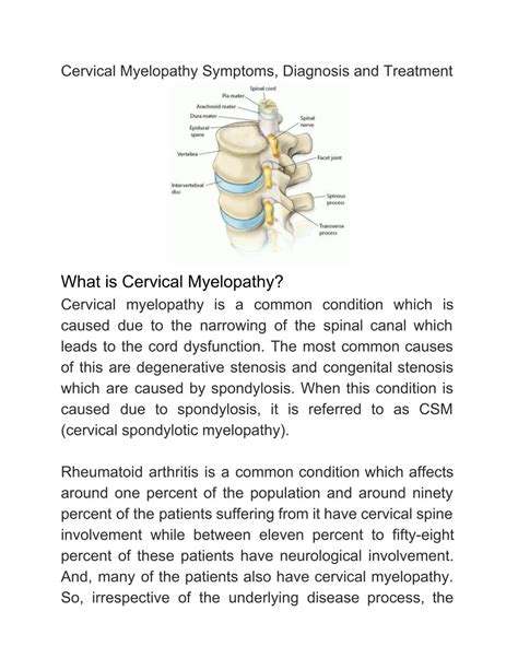 PPT - Cervical Myelopathy Symptoms, Diagnosis and Treatment PowerPoint ...